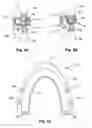 Fig. 04 - Breathing assist device
