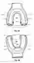 Fig. 06 - Breathing assist device