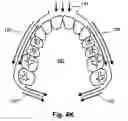 Fig. 11 - Breathing assist device