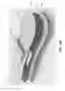 Fig. 32 - Cooling devices for providing cooling therapy to the body