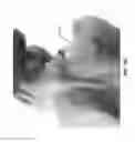 Fig. 46 - Cooling devices for providing cooling therapy to the body