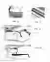 Fig. 05 - Therapeutic eye pod system