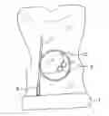Fig. 01 - NOVEL DEVICE FOR ANESTHETIZING THE EYE