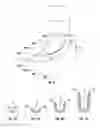Fig. 06 - Devices, system and methods for minimally invasive glaucoma surgery