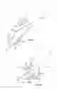 Fig. 09 - Devices, system and methods for minimally invasive glaucoma surgery