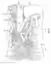 Fig. 10 - Devices, system and methods for minimally invasive glaucoma surgery