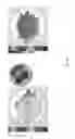 Fig. 08 - Systems and methods for corneal laser ablation