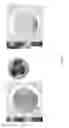 Fig. 10 - Systems and methods for corneal laser ablation