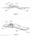 Fig. 12 - SYSTEMS, APPARATUSES, KITS AND METHODS FOR IMPROVED MEDICAL PROCEDURES