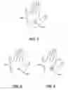 Fig. 04 - Wound dressing assembly