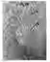 Fig. 06 - Devices and methods for supporting and containing premature babies and small-for-age infants