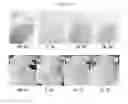 Fig. 03 - Cosmetic composition for preventing or ameliorating hypersensitive skin comprising cedrol or derivatives thereof, or pharmaceutically acceptable salts thereof