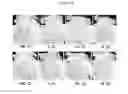 Fig. 04 - Cosmetic composition for preventing or ameliorating hypersensitive skin comprising cedrol or derivatives thereof, or pharmaceutically acceptable salts thereof