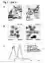 Fig. 02 - LPA LEVEL REDUCTION FOR TREATING CENTRAL NERVOUS SYSTEM DISORDERS