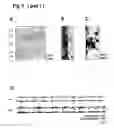 Fig. 07 - LPA LEVEL REDUCTION FOR TREATING CENTRAL NERVOUS SYSTEM DISORDERS
