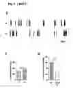 Fig. 08 - LPA LEVEL REDUCTION FOR TREATING CENTRAL NERVOUS SYSTEM DISORDERS