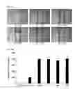 Fig. 10 - Composition for preventing or treating vascular leak syndrome
