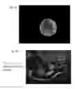 Fig. 02 - Macro-encapsulated therapeutic cells and methods of using the same