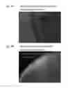 Fig. 05 - Macro-encapsulated therapeutic cells and methods of using the same
