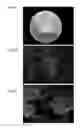 Fig. 07 - Macro-encapsulated therapeutic cells and methods of using the same