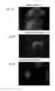 Fig. 09 - Macro-encapsulated therapeutic cells and methods of using the same
