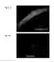 Fig. 10 - Macro-encapsulated therapeutic cells and methods of using the same