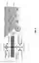Fig. 03 - Compositions and methods for invasive and non-invasive procedural skincare