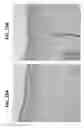 Fig. 16 - Compositions and methods for invasive and non-invasive procedural skincare