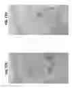 Fig. 19 - Compositions and methods for invasive and non-invasive procedural skincare
