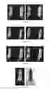 Fig. 07 - PSMA binding ligand-linker conjugates and methods for using