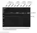 Fig. 01 - Polynucleotides encoding methylmalonyl-CoA mutase