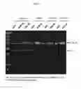 Fig. 06 - Polynucleotides encoding methylmalonyl-CoA mutase