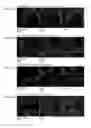 Fig. 07 - Polynucleotides encoding methylmalonyl-CoA mutase