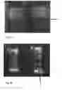 Fig. 06 - Composite collagen hydrogel material, an implantable opthalmic device comprising such material and methods of producing the composite collagen hydrogel material and the implantable ophthalmic device