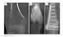 Fig. 01 - COMPOSITIONS AND METHODS FOR TREATMENT OF BONE DEFECTS