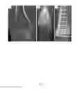 Fig. 02 - COMPOSITIONS AND METHODS FOR TREATMENT OF BONE DEFECTS