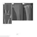 Fig. 04 - COMPOSITIONS AND METHODS FOR TREATMENT OF BONE DEFECTS