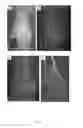 Fig. 12 - COMPOSITIONS AND METHODS FOR TREATMENT OF BONE DEFECTS