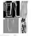 Fig. 07 - Composite materials for bone repair based on decellularized biological tissue matrix material and the preparation method thereof