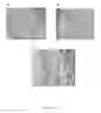 Fig. 07 - Tissue scaffold materials for tissue regeneration and methods of making