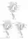 Fig. 13 - DENTAL DEVICE AND SUCTION DEVICE