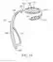 Fig. 16 - DENTAL DEVICE AND SUCTION DEVICE