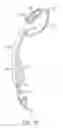 Fig. 17 - DENTAL DEVICE AND SUCTION DEVICE