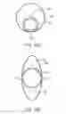 Fig. 20 - DENTAL DEVICE AND SUCTION DEVICE