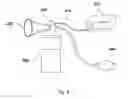 Fig. 03 - Apparatus for Improving Experience of Breastfeeding