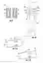 Fig. 06 - Apparatus and method for cannulation of vascular access graft