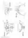 Fig. 04 - Valsalva mask