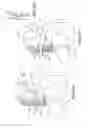 Fig. 06 - Valsalva mask