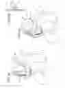 Fig. 07 - Valsalva mask