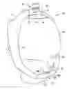 Fig. 01 - Positive-air-pressure machine conduit
